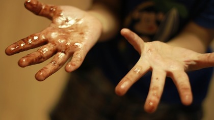 Ребенок обжег руки на детской площадке в Ленинске-Кузнецком