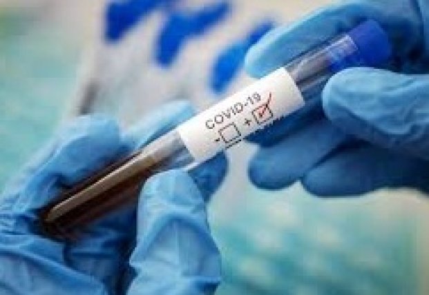В Украине 5 336 новых случаев коронавируса